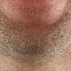 Illustration for article titled Whose Disgusting Baseball Chin Is This?